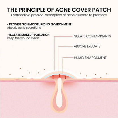 Pimple Pop (acne stickers)